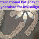 Best Dental Clinic for Invisalign in Hyderabad