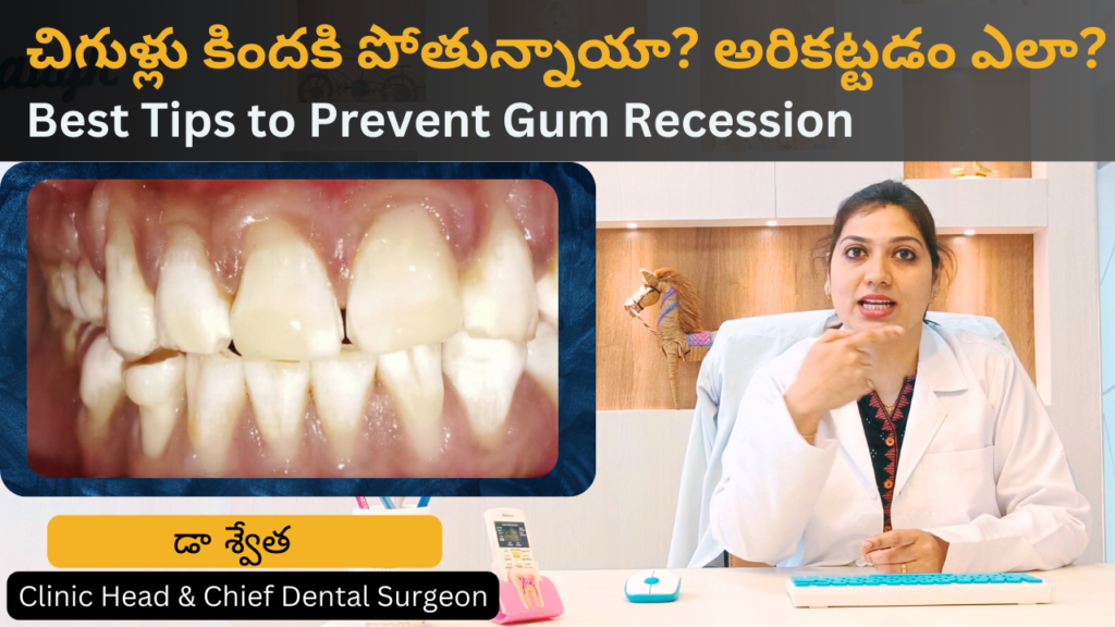 How to prevent gum recession? in Telugu by Dr Swetha