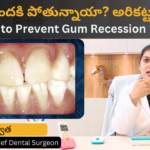 How to prevent gum recession? in Telugu by Dr Swetha