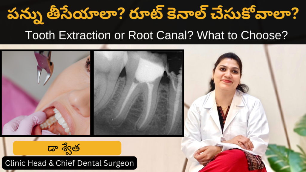 Tooth Extraction vs Root Canal? in Telugu by Dr Swetha