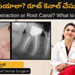 Tooth Extraction vs Root Canal? in Telugu by Dr Swetha