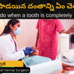 What to do when a tooth is completely decayed? in Telugu by Dr Swetha