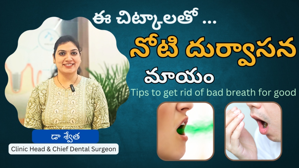 నోటి దుర్వాసన పోవాలా ? 7 Tips to Get Rid of Bad Breath for Good in Telugu | Dr Swetha | Hyderabad