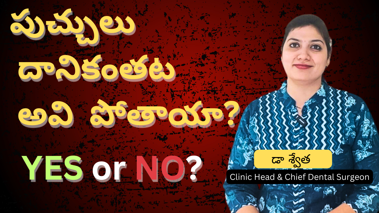 పుచ్చులు దానికంతట అవి పోతాయా? Do Teeth Cavities Go Away on Their Own? in Telugu | Dr Swetha | Best Dental Hospital in Hyderabad