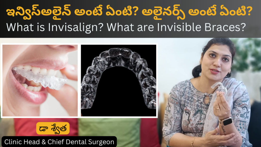What is Invisalign or Invisible Braces ? by Dr Swetha @ KPHB