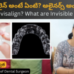 What is Invisalign or Invisible Braces ? by Dr Swetha @ KPHB