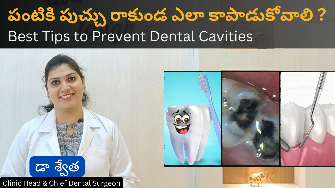 Best Tips to Prevent Dental Cavities in Telugu by Dr Swetha