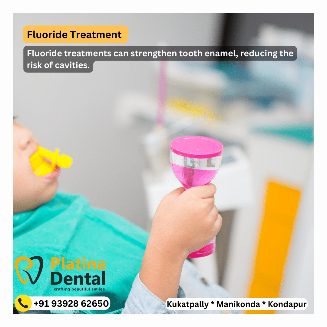 fluoride treatment platina dental