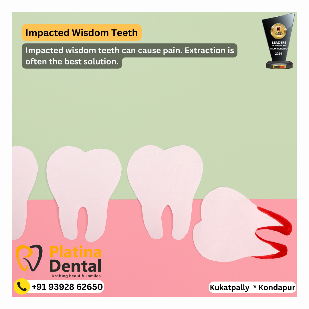 wisdom tooth pain | gnana dantam | best dentist in hyderabad