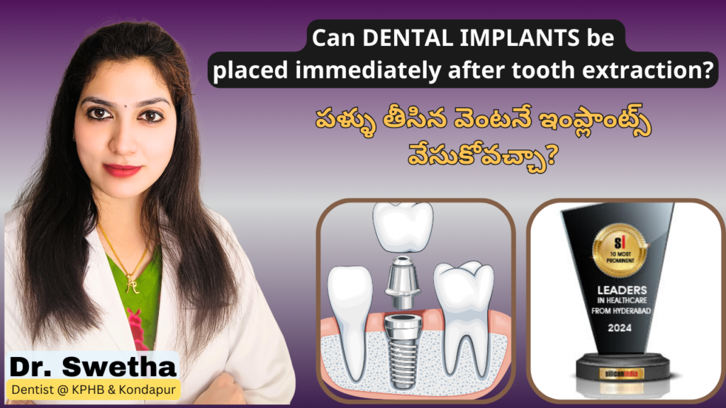 Best Dental Clinic near me for Immediate Dental Implant Placement After Tooth Extraction