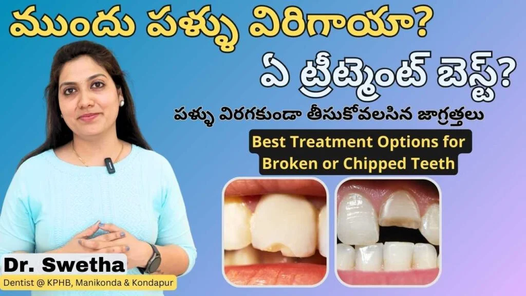 front broken teeth treatment