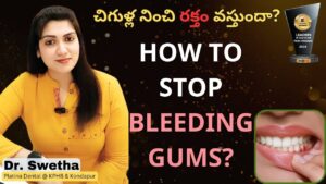 bleeding gums 1