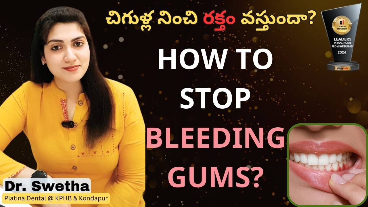 bleeding gums 1