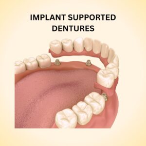 implant pic 2