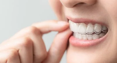 Invisalign Treatment