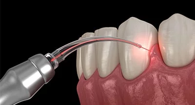 Periodontics