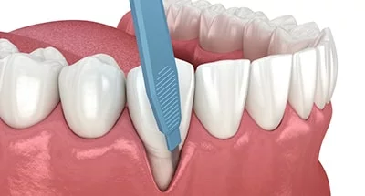 Restorative Dentistry