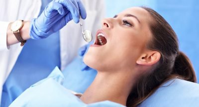 best teeth cleaning polishing in hyderabad