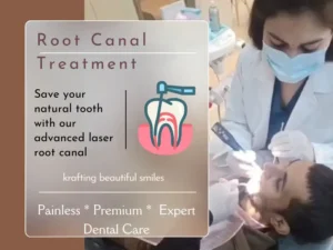 laser root canal