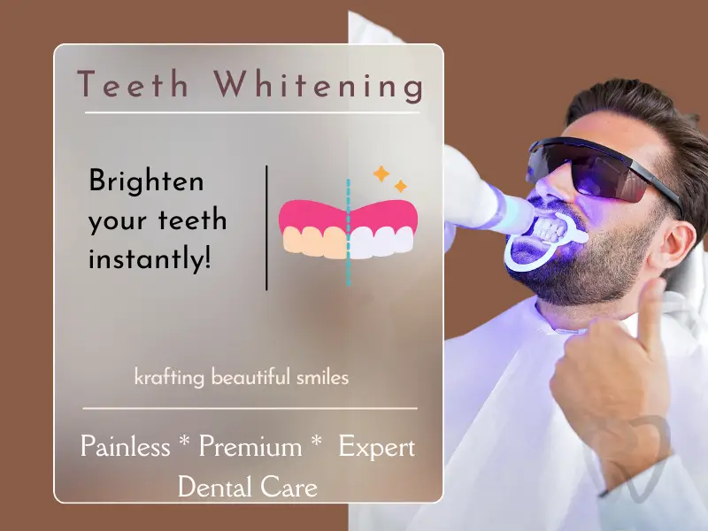 teeth whitening in hyderabad