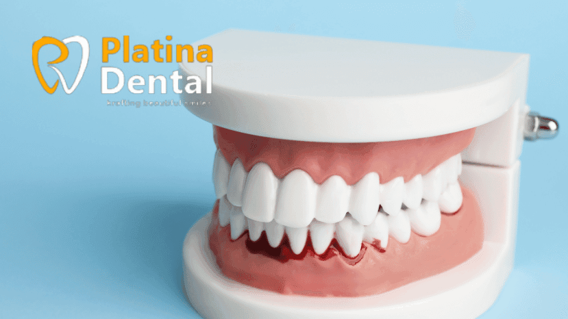 Top 10 Essential Tips for Maintaining Healthy Teeth and Gums  Expert Dental Care by Platina Dental