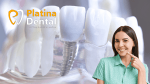 Top 10 Essential Tips for Maintaining Healthy Teeth and Gums Expert Dental Care by Platina Dental