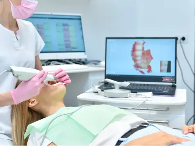 3D Intra Oral Scanner