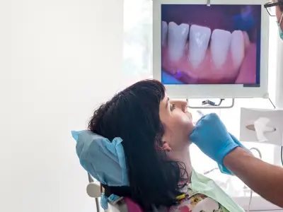 Intra Oral Camera