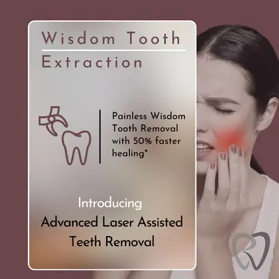 wisdom tooth extraction hyderabad