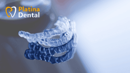 Aligners Vs Braces : Which option is Right for you | Platina Dental