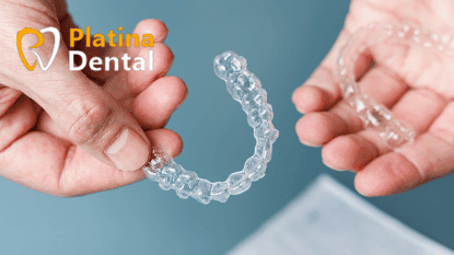 Benefits of Clear AlignersBenefits of Clear Aligners