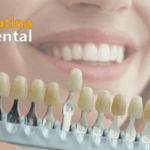 Benefits of Cosmetic Dentistry