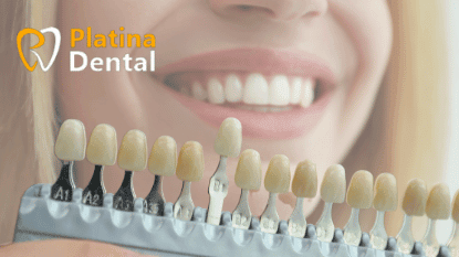 Benefits of Cosmetic Dentistry