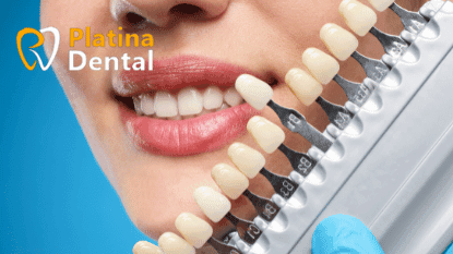 Benefits of Cosmetic Dentistry