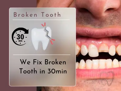 broken tooth repair in hyderabad