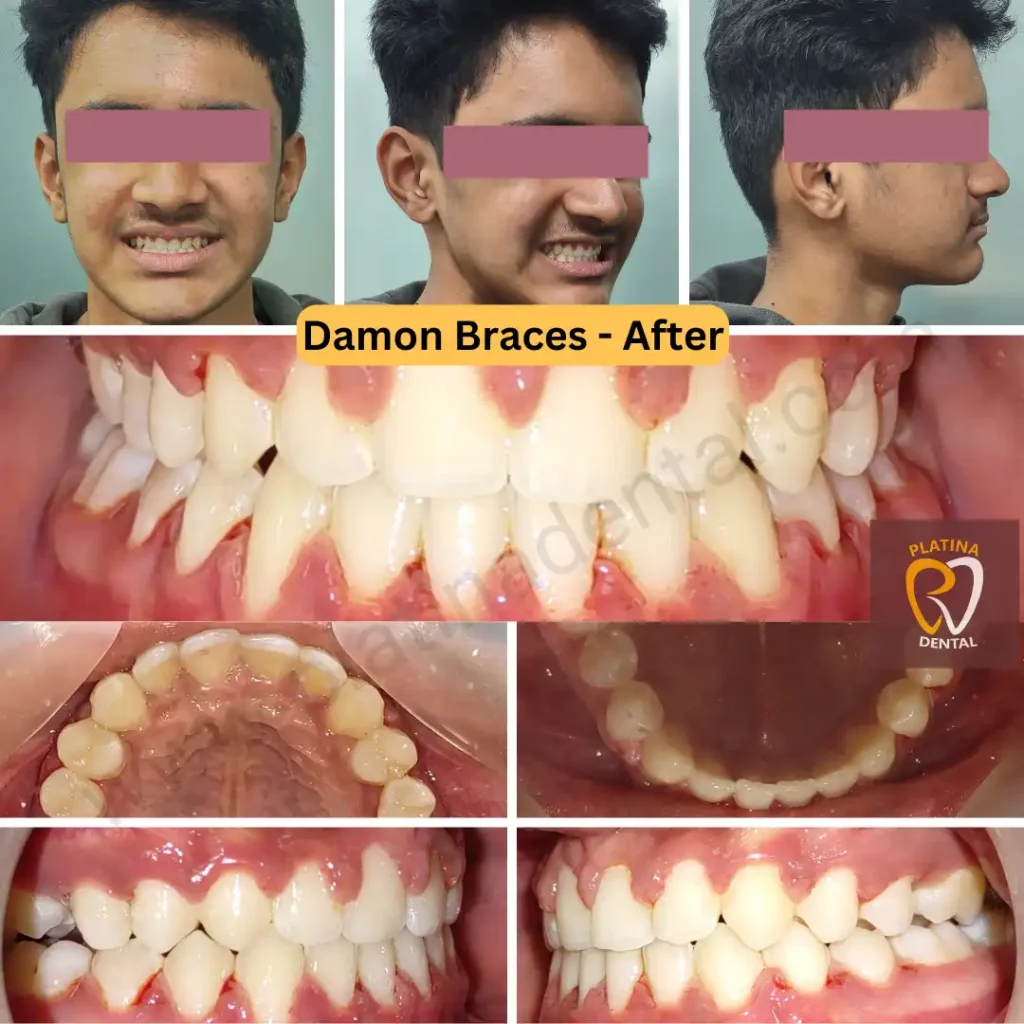 best orthodontist in hyderabad