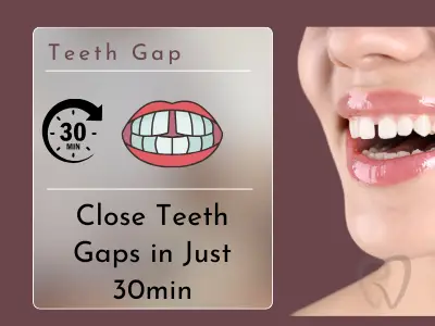 teeth gap 2