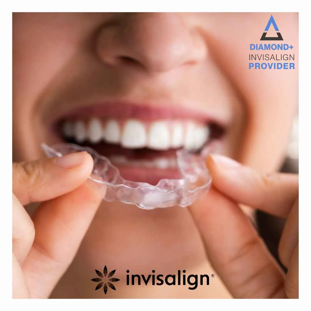 Invisalign faqs