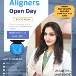 platina aligner