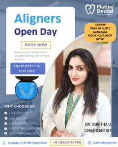platina aligner