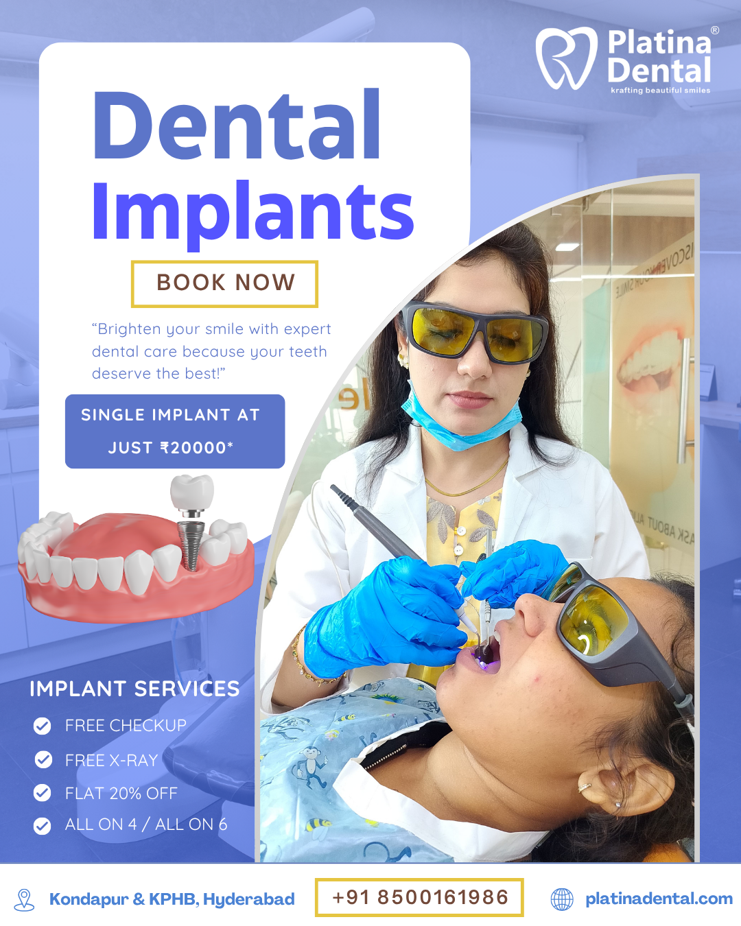platina implants 1 1