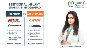 Best Dental Implant Brands in Hyderabad