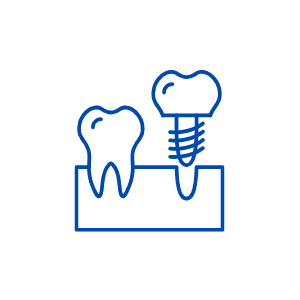 Full Mouth Dental Implants 1 full mouth dental implants