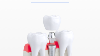 dental implant cost in hyderabad