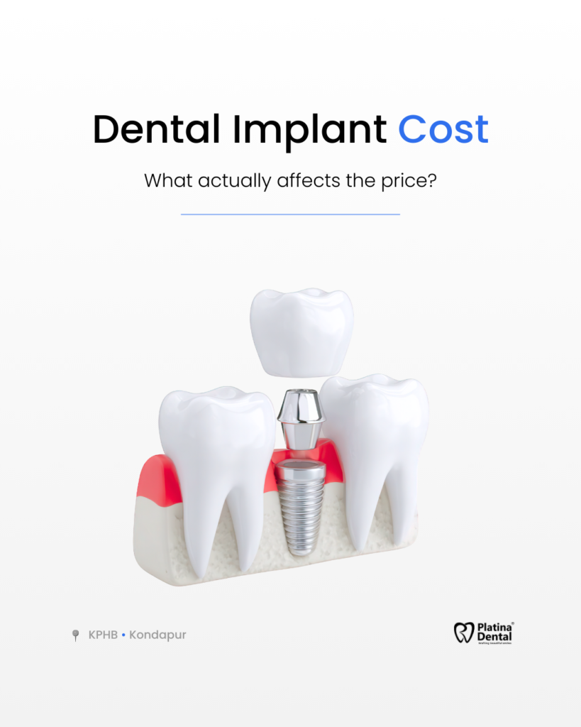 Dental Implant Cost
