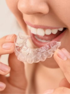 clear aligners kondapur